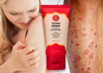 Yenki Derm recenze – pro rychlé zotavení z lupénky