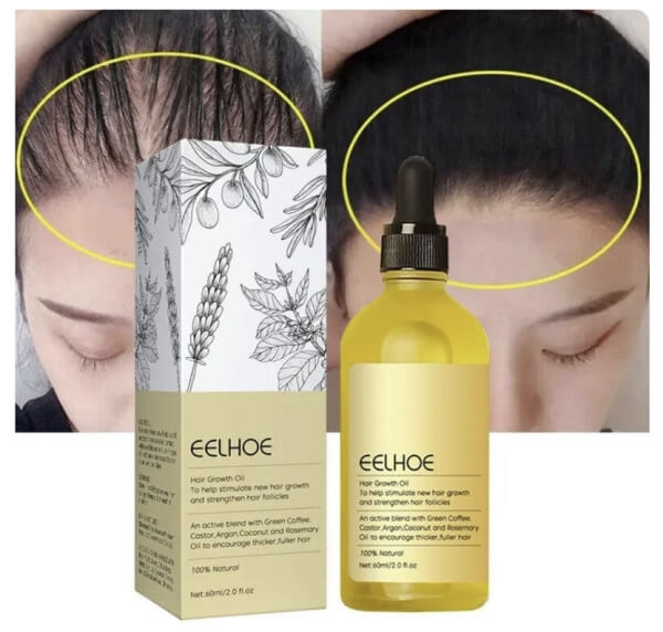 Cena EELHOE Hair Growth Oil v Česku – kde koupit