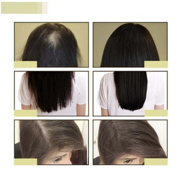 EELHOE Hair Growth Oil – co to je a jak to funguje