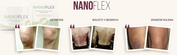 Co je NanoFlex a jak funguje Co je NanoFlex a jak funguje